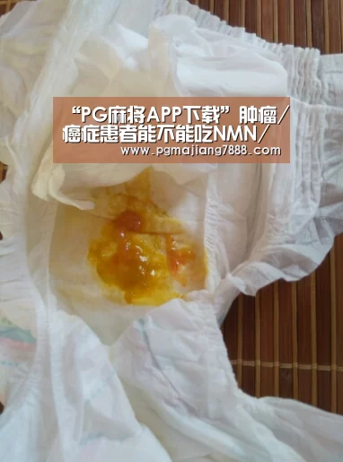 “PG麻将APP下载”肿瘤/癌症患者能不能吃NMN/β-烟酰胺单核苷酸?(图2) PG麻将APP下载